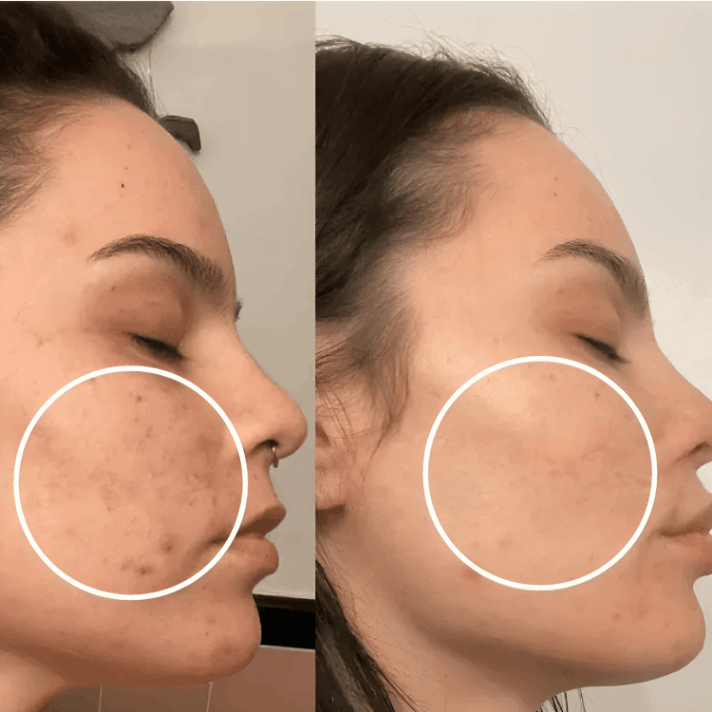 Lucinn Pro Filtered Showerhead customer review Katryn