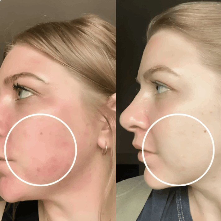 Lucinn Pro Filtered Showerhead customer review Brie